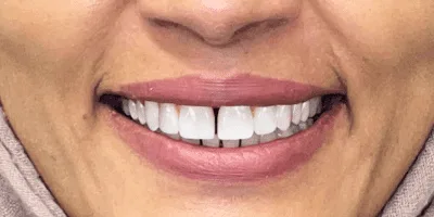 cosmetic dentistry - pearl dental surgery norwich