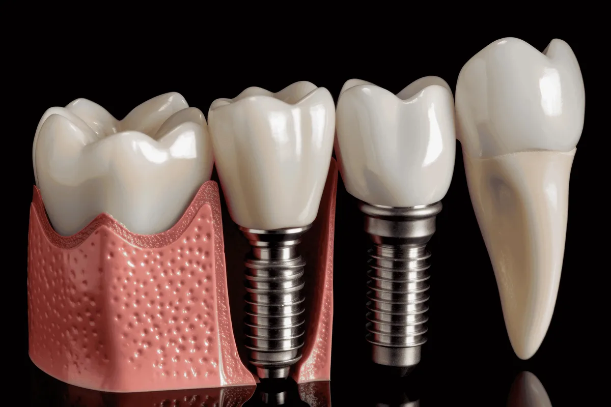 dental implants norwich - Pearl dental surgery