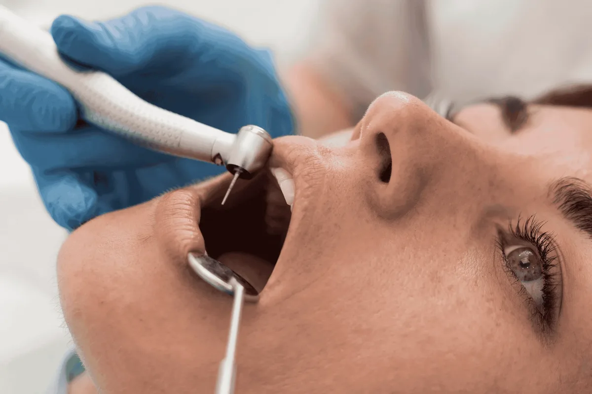 Know About Dental Filling And Its Process at Pearl Dental Surgery