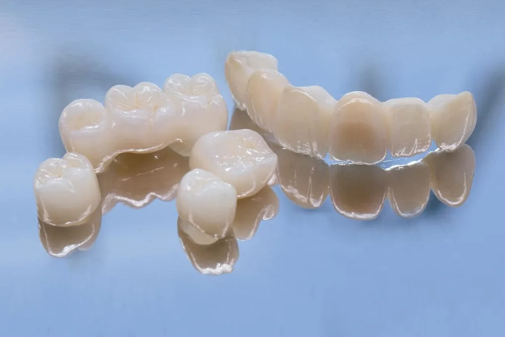 Why Dental Crowns are Matter & When They’re Necessary