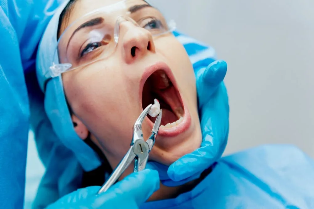 Is Dental Extraction Necessary? Common Reasons & Solutions