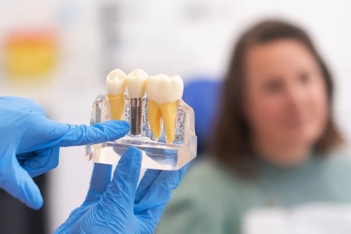dental implants in Norwich