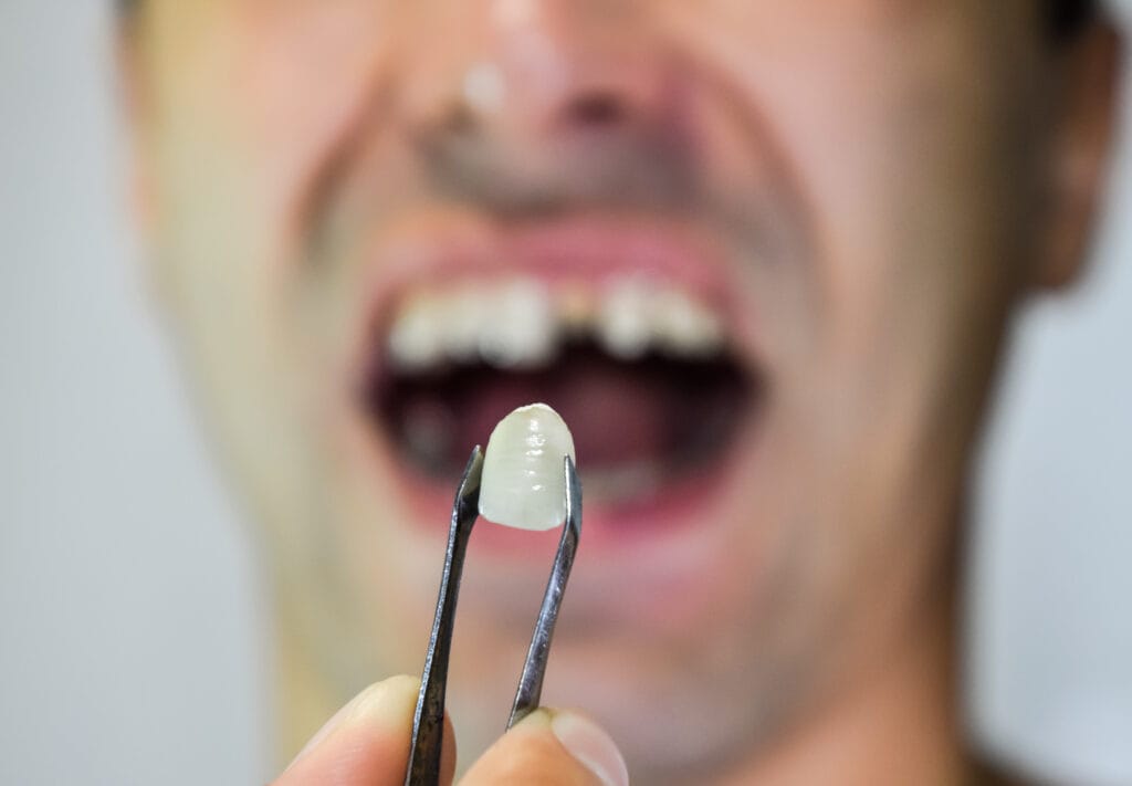 “Dental implant suitability with gum disease – expert advice from dentists”