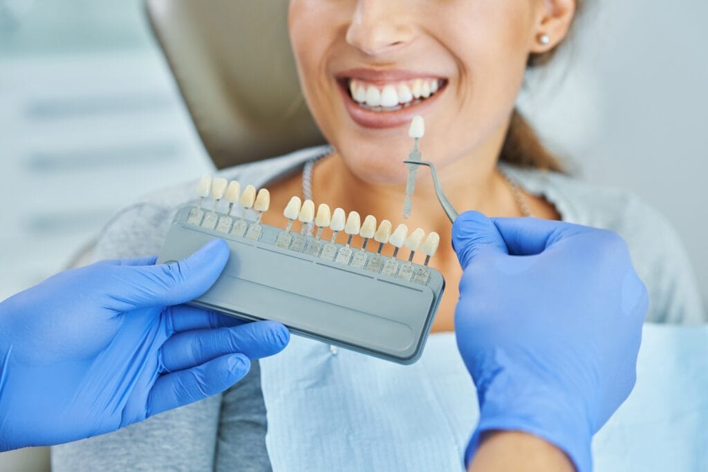 Dental veneers explained by a cosmetic dentist in Norwich