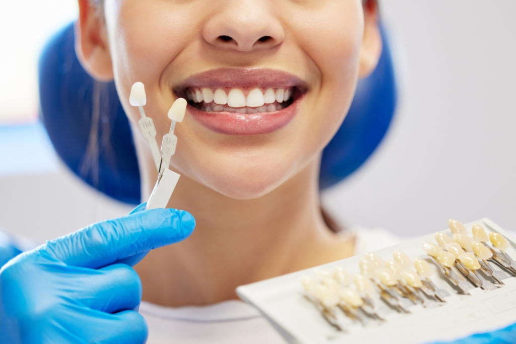 Patient smiling after Composite Bonding treatment at Pearl Dental Surgery Norwich