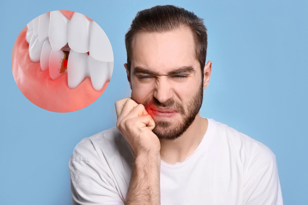 broken-or-cracked-tooth-how-soon-see-dentist